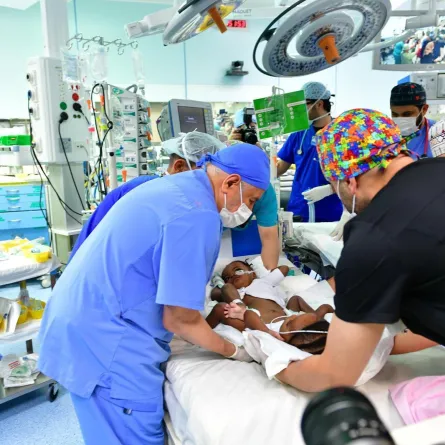 فصل التوأم السيامي النيجيري حسنة وحسينة 