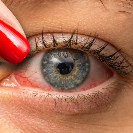 صورة لعين امرأة