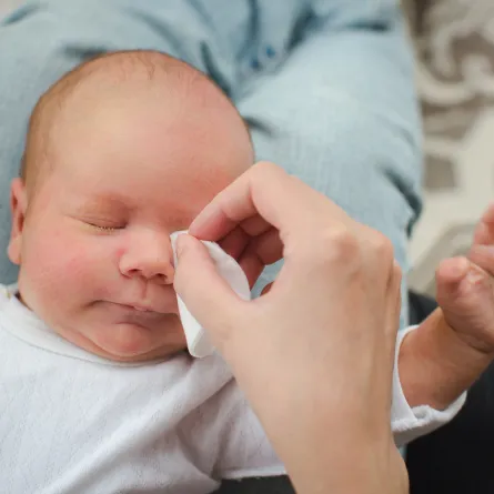 علاج رمد العين عند حديثي الولادة