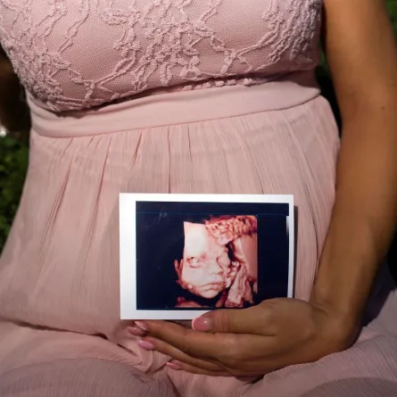 صورة حامل تحمل صورة الجنين