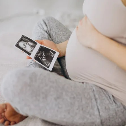 صورة لامرأة حامل