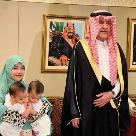 التوأم السيامي