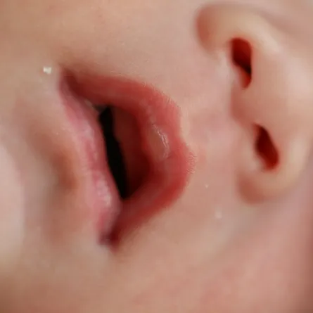 صورة لرضيع يفتح فمه عند النوم