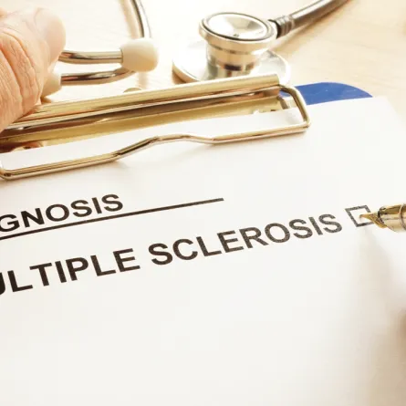 التصلب المتعدد: كل ما تودين معرفته عن المرض