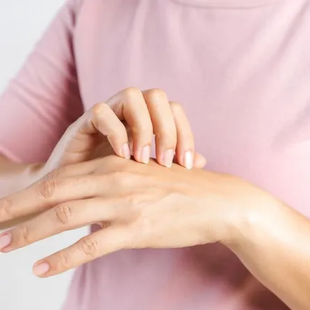 امرأة تعاني من الحكة بسبب الحساسية الجلدية