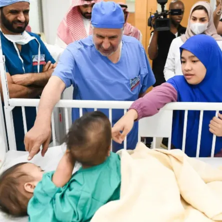 التوأم السيامي