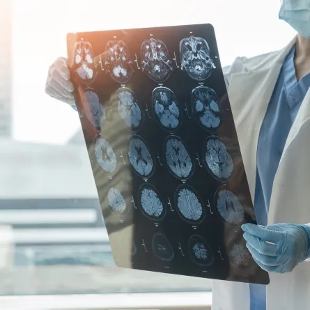  الحمى الشوكية والعلاجات المتاحة