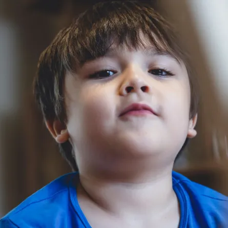 صورة طفل زائد الوزن