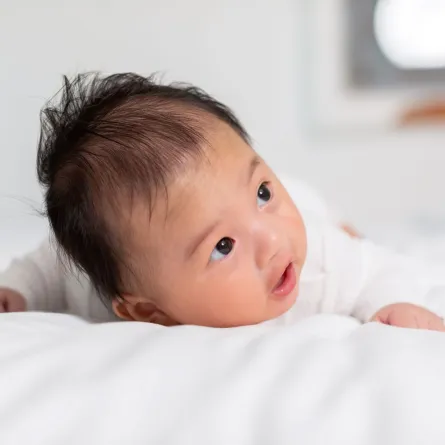 صورة لرضيع لديه تساقط في مقدمة رأسه