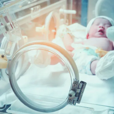 صورة لطفل مبتسر في الحضانة الصناعية