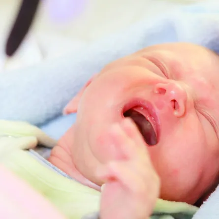 صورة لرضيع مصاب بالامساك المزعج الذي يسبب له المغص والانتفاخ