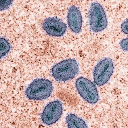  الصحة العالمية تعلن جدري القرود حالة طوارئ صحية بعد تفشيه في عدد من الدول