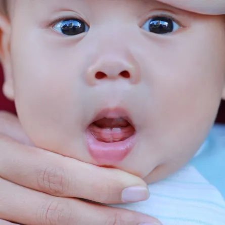 صورة لرضيع في بداية مرحلة التسنين