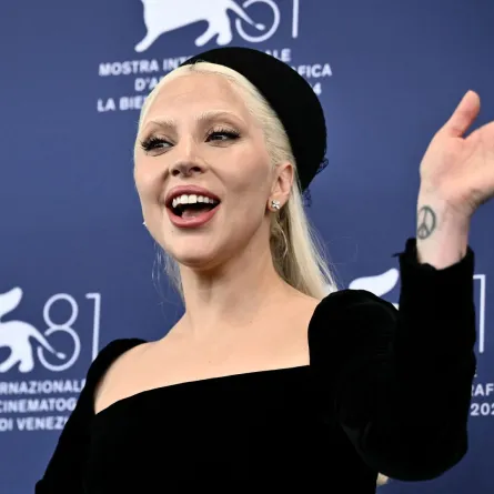 ليدي غاغا في ليدو فينيسيا (Lady Gaga at Venice Lido). مصدر الصورة: Marco BERTORELLO / AFP