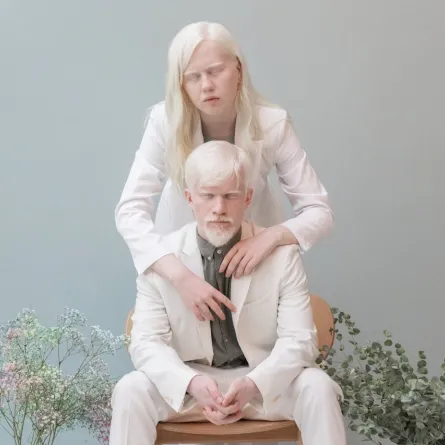 مصابان بمرض المهق