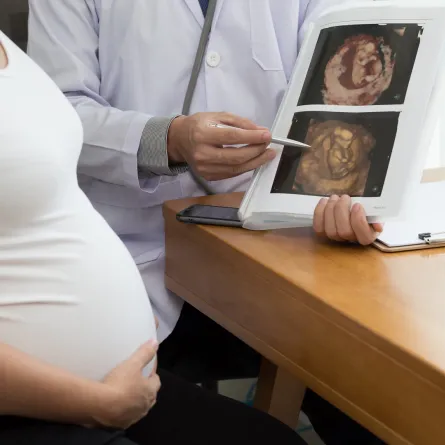 صورة لامرأة حامل