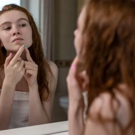 صورة مراهقة تتفقد بشرتها