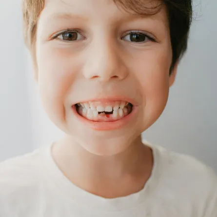 صورة أسنان الطفل