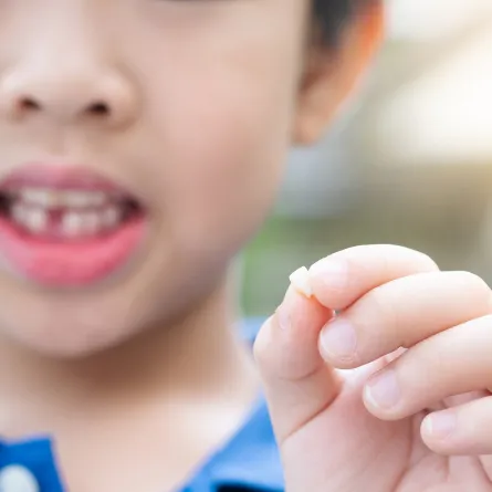 صورة لطفل يحمل أسنانه اللبنية