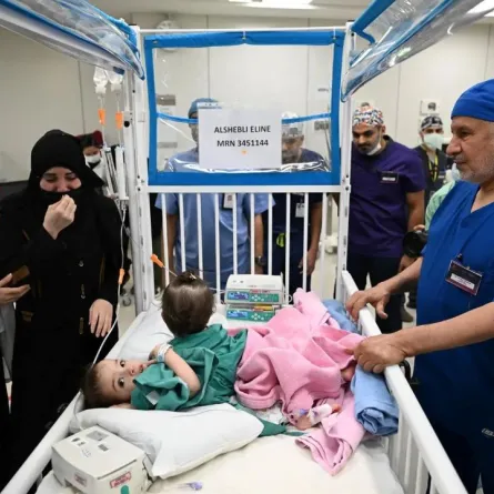 هذه العملية تُعد الرابعة لفصل توائم ملتصقة من سوريا