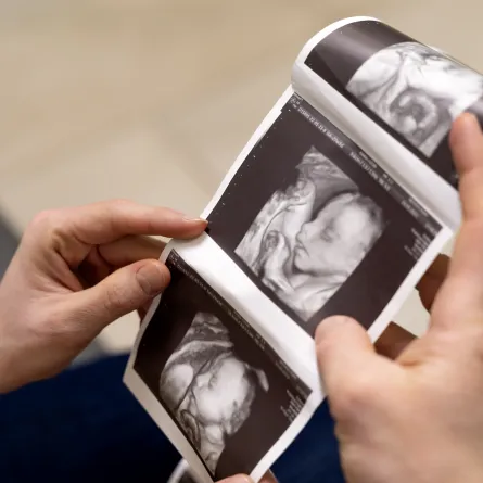 صورة لسونار