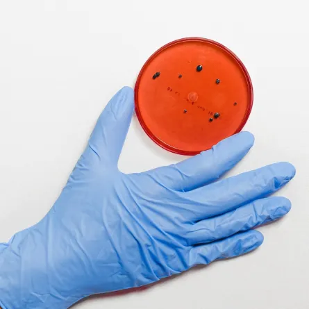 فحص للدم يشكف الإصابة بالزهايمر باكراً- المصدر: pexels-anna-shvets