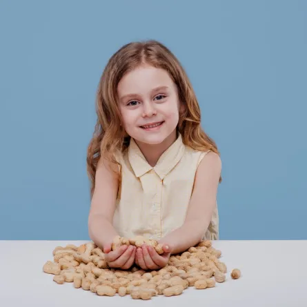 صورة حساسية الطعام