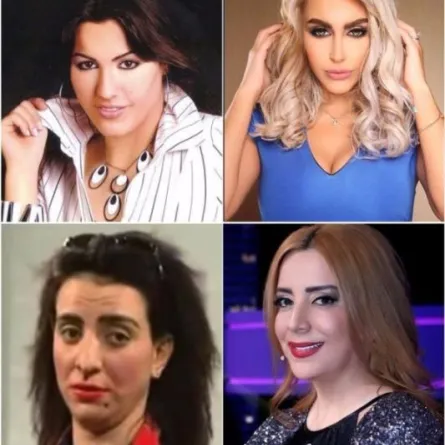 10 نجمات صدمن العالم العربي بعد التجميل