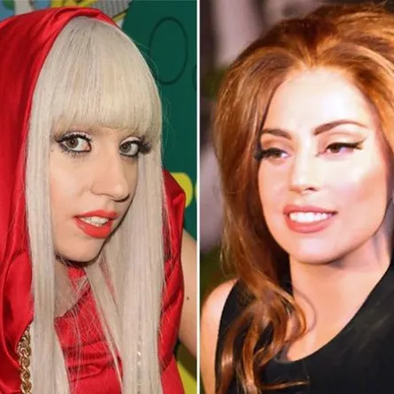 أنوف النجمات قبل وبعد عمليّات التجميل!