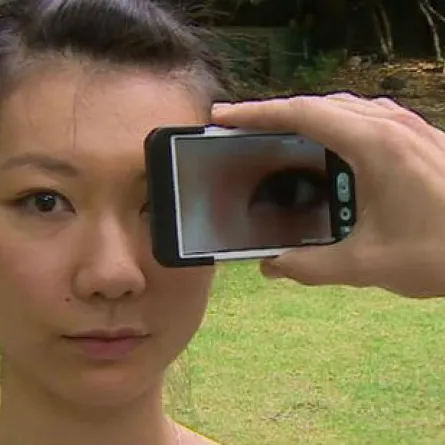 تطبيق ذكي يقوم بتشخيص أمراض العيون