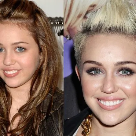 نجمات هوليوود قبل وبعد عمليات التجميل!