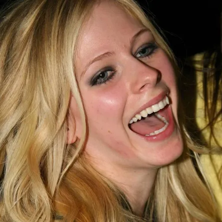 نجمات شهيرات بأسنان قبيحة