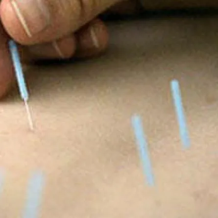 العلاج الصيني يخلصك من آلام الظهر وهشاشة العظام!