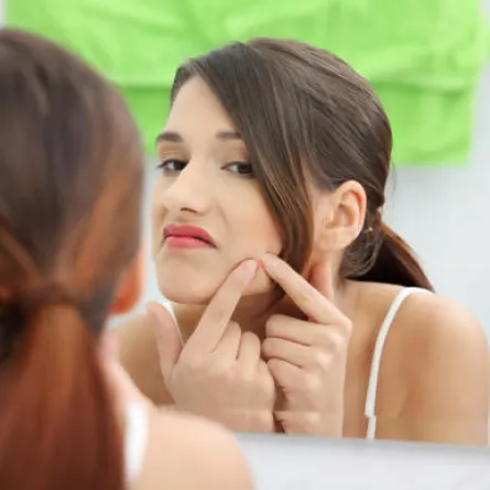 حقائق تجهلينها عن حَب الشباب