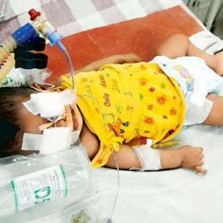 وفاة رضيعة هنديّة بسبب وحشيّة والدها