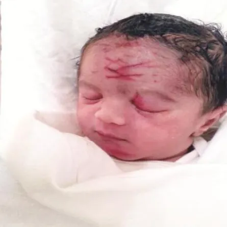 في الرياض.. طبيب يخربش على وجه رضيع