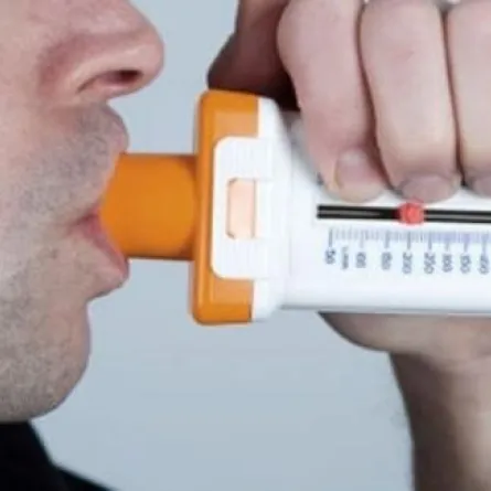 اختبار تنفس بسيط يكشف سرطان المعدة