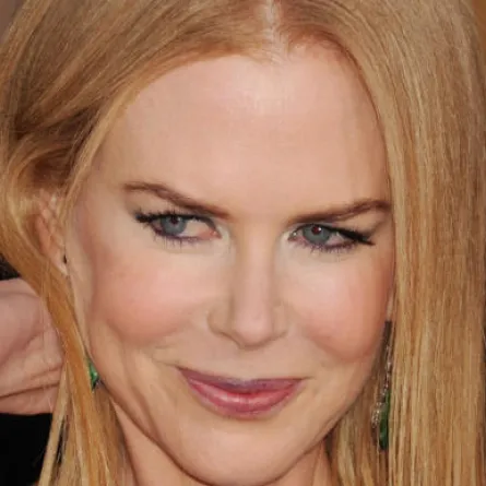 نيكول كيدمان تعترف بحقن البوتوكس!