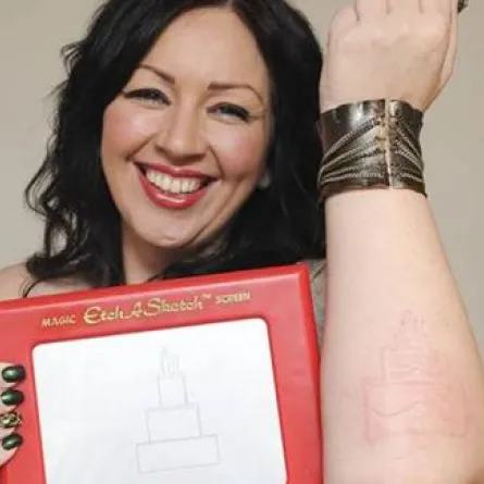 أم بريطانية تعاني مرضاً جلديًا غريبًا يحولها إلى لعبة "رسم"