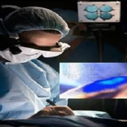 "نظارات" تُمكّن الجراحين من تمييز الخلايا السرطانية