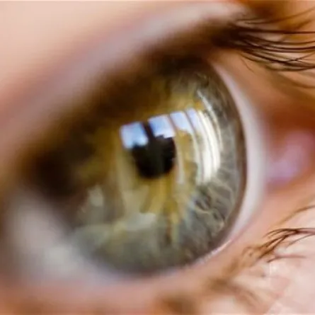 إصابة 30 شخصاً بالعمى والسبب خطأ طبي