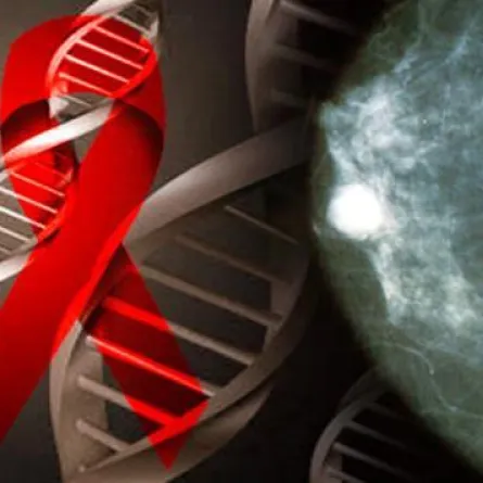 تقنية جديدة.. علاج سرطان الثدي بالتجميد
