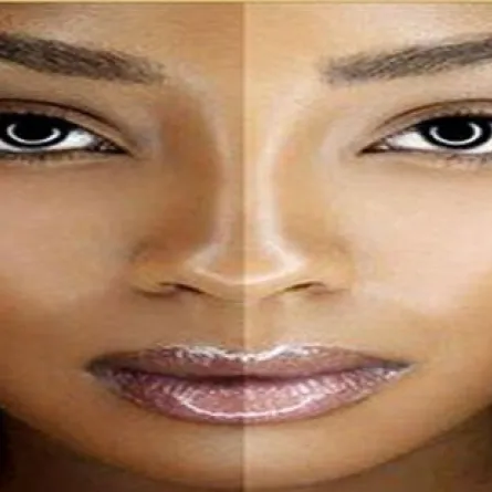 "البرونزاج".. قد يضر بشرتك