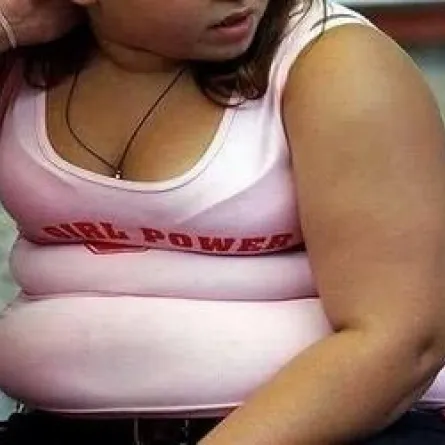 البطن بشكل التفاحة يزيد احتمال الإصابة بأمراض الكلى