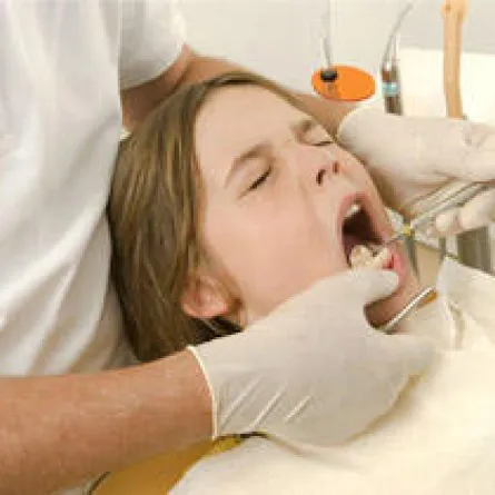 تسوس الأسنان يقلل فرص الإصابة بسرطان الفم والحلق