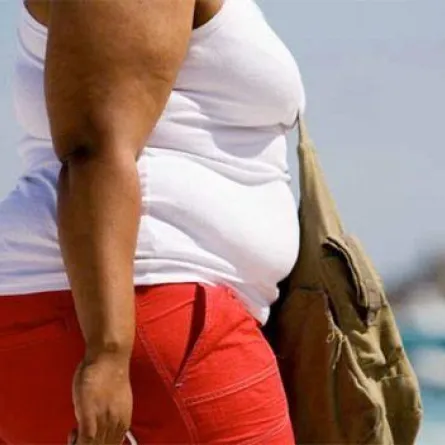 السمنة تقتل مرضى سرطان اللسان