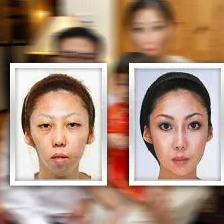 رجل يفوز بتعويض 120 ألف دولار من زوجته لإنجابها طفلة قبيحة