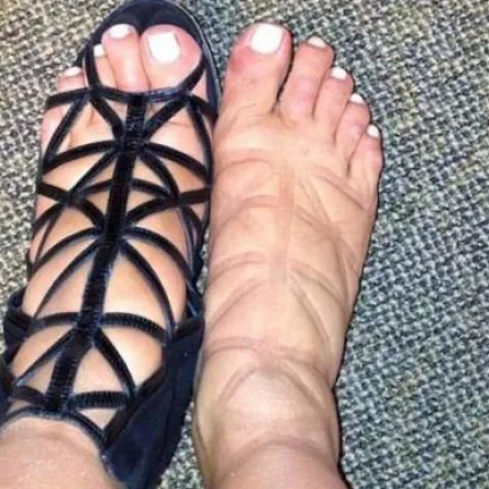 بالصور: شناعة رجلي kim kardashian