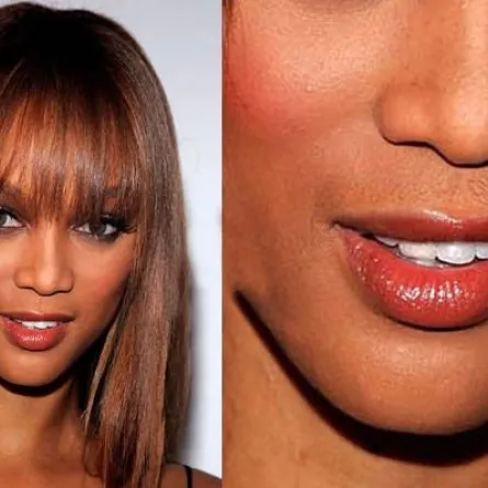 عيوب جماليّة فاضحة جداً لنجمات هوليوود!