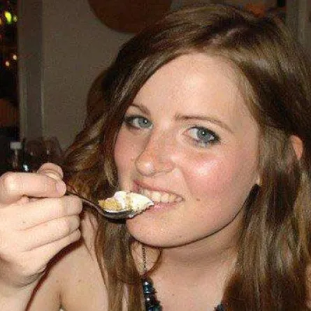 شطيرة برغر تتسبب بخلع فك امرأة بريطانية